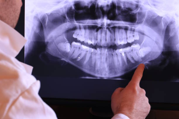 Best Pediatric Emergency Dentist in Rossville, GA