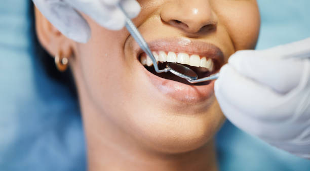 Best Emergency Cosmetic Dentistry in Rossville, GA
